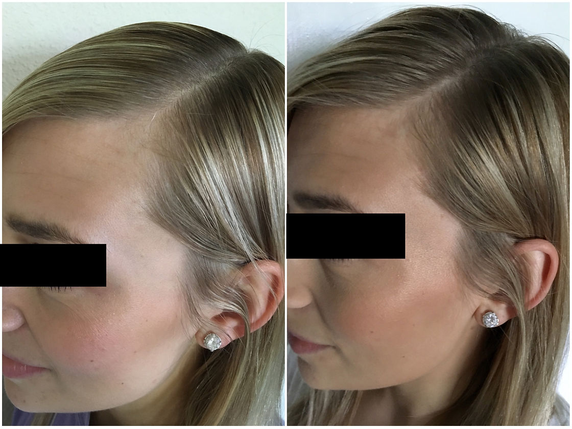 Hair Strengthening Spray with MHCsc™ Technology