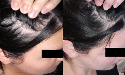 Stimulating Scalp Spot Treatment with MHCsc™ Technology