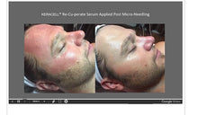 KERACELL MD® Re-Cu-Perate™ Recovery Serum